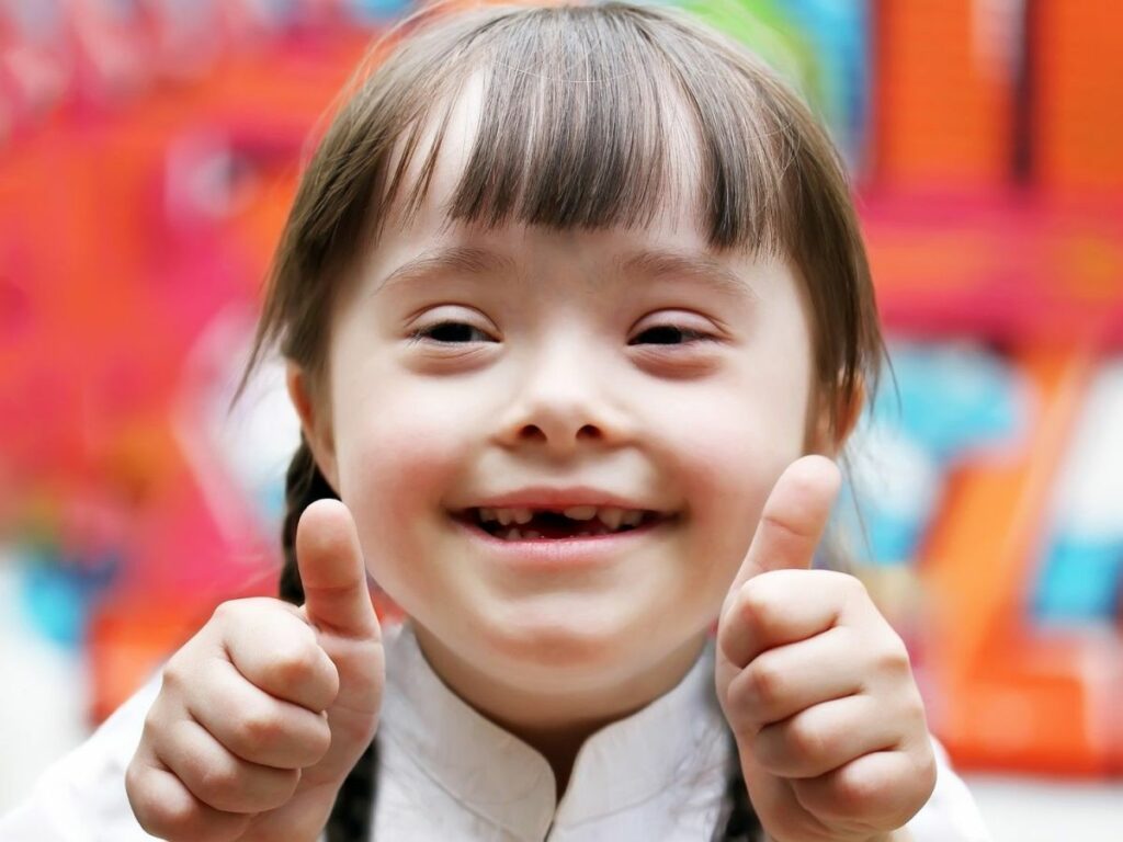 Fakta Dan Mitos Down Syndrome | WeCare.id