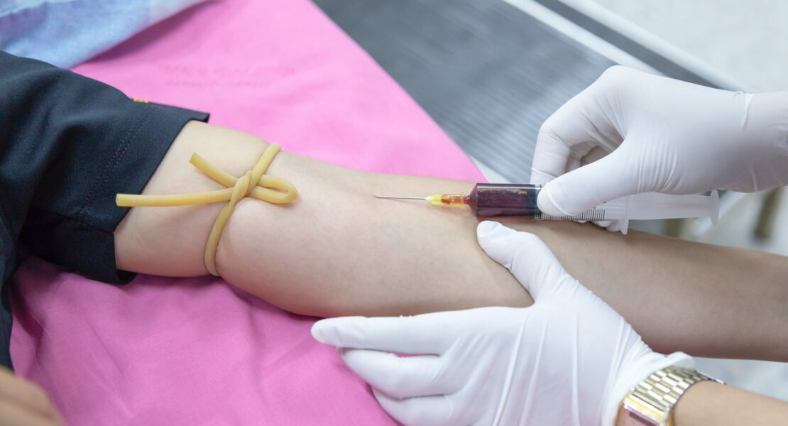 Ciri-Ciri Kanker Darah dan Cara Pengobatannya | WeCare.id