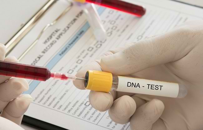 Ini Manfaat Lain Tes DNA Selain Garis Keturunan | WeCare.id