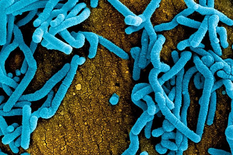 Virus Penyakit Marburg Serang Afrika Tengah, Ini Bahayanya! | WeCare.id