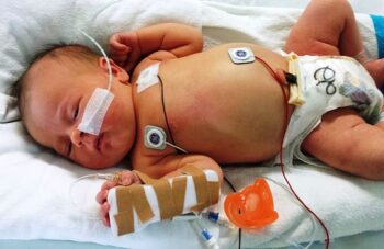 Begini Cara Agar Konsisten Menurunkan Berat Badan | Wecare.id