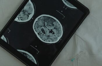 Benarkah Covid-19 Sebabkan Brain Fog AKA Kabut Otak? | WeCare.id
