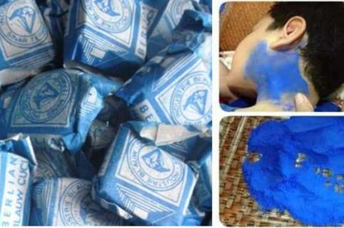 Cara Pengobatan Gondongan dengan Blau: Mitos atau fakta?