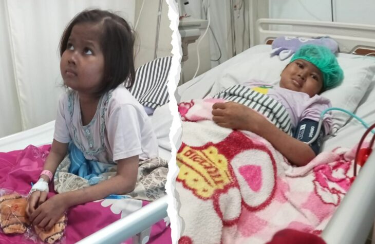 Kisah Mozza: Hidup dengan Penyakit Autoimun SLE | WeCare.id
