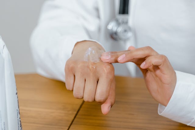7 Jenis Obat Dermatitis Eksim dan Cara Pakainya